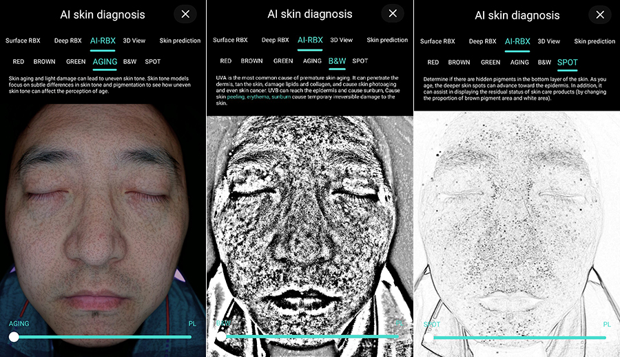 Hvorfor bruger flere og flere æstetiske centre Skin Analyzer?